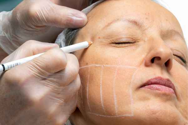 CryoPen: 5 Skin Concerns It May Be Used to Treat 4 What should you ask before having CryoPen treatment Bordesley?