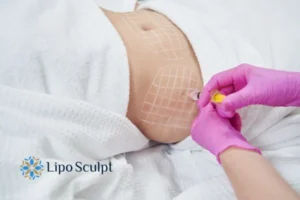 Are The Results From Aqualyx Permanent? 1 Do you want to know how long Aqualyx Bordesley results last?